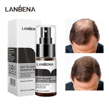 Спрей-эссенция для быстрого роста волос LANBENA, предотвращающий облысение, укрепляющий, против выпадения волос, питающий корни, восстанавливающий рост волос